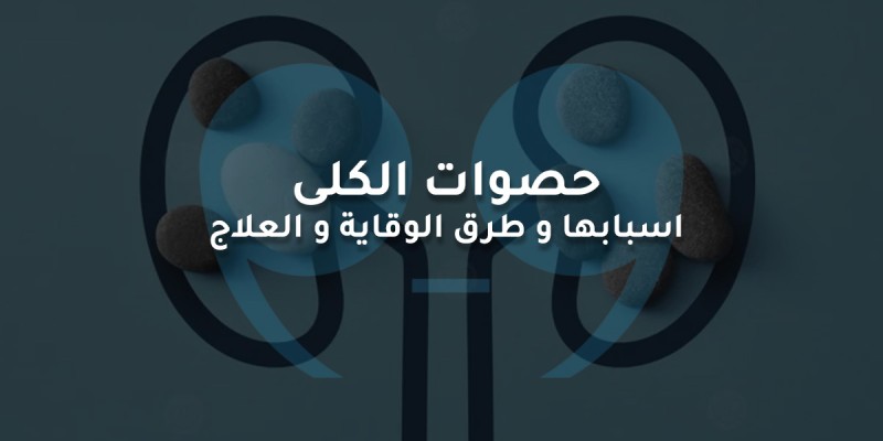 حصوات الكلى اسبابها و طرق الوقاية و العلاج